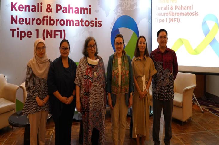 Untuk pertama kalinya di Indonesia, anak-anak dengan NF1 yang mengalami neurofibroma pleksiform (NP) dan tidak dapat dioperasi kini memiliki akses terhadap Selumetinib (Foto : Ist)