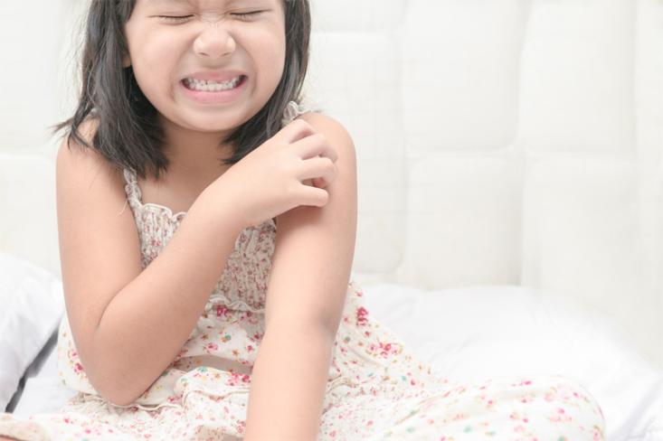 Deteksi dini alergi pada anak, agar bebas khawatir. Foto: Ist