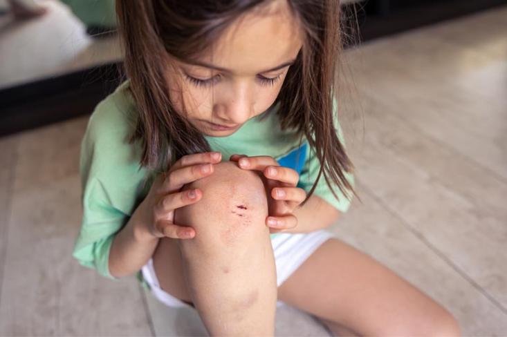 Usia 2 hingga 5 tahun memang sedang aktif bereksplorasi, sehingga meningkatkan terjadinya luka kecil ketika menjalani aktivitas sehari-hari (Foto : Freepik)