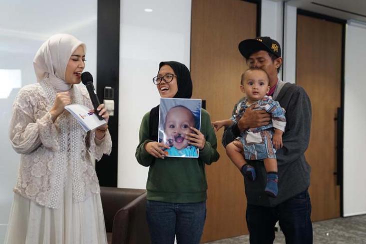Okta menunjukan foto Muhammad Al – Fakih, sebelum dan sesuadah dioperasi oleh Smile Train (Foto : Ist)