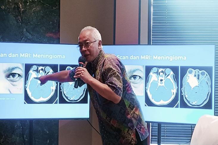 dr. Moch. Evodia Slamet R., Sp.BS, Spesialis Bedah Saraf sedang memberi penjelasan pada media gathering RS Premier Bintaro bertajuk “Tumor Otak Dapat Ditangani dengan Optimal Jika Dideteksi Sejak Dini” di Jakarta (Foto: Efa)